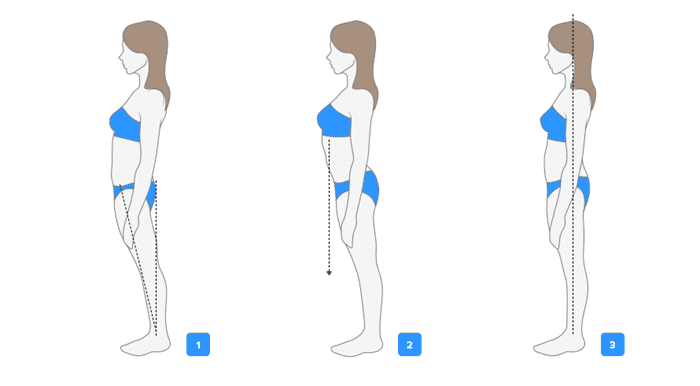 دیاستازیس رکتی