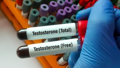 تستوسترون آزاد